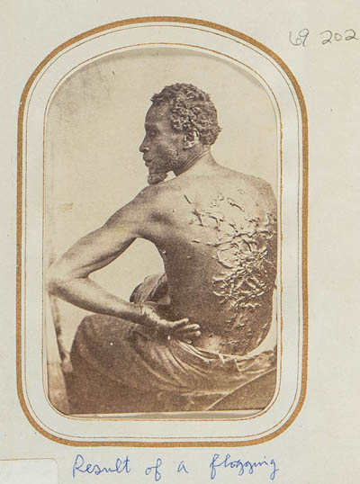 Gordon, an enslaved man, showing his scarred back Photograph